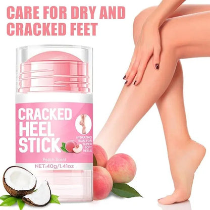 60% Urea Cream plus 2% Salicylic Acid - 1.41 oz Urea Foot Hand Cream Stick for Repairing Restore Balm