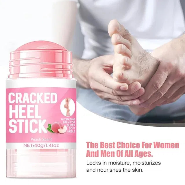 60% Urea Cream plus 2% Salicylic Acid - 1.41 oz Urea Foot Hand Cream Stick for Repairing Restore Balm