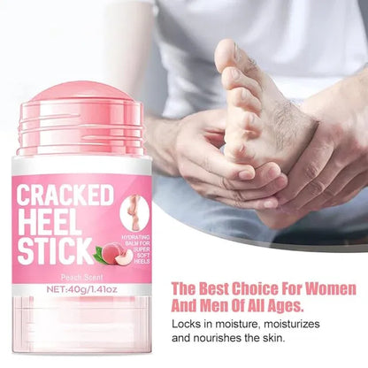 60% Urea Cream plus 2% Salicylic Acid - 1.41 oz Urea Foot Hand Cream Stick for Repairing Restore Balm